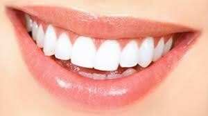Teeth Whitening- Buy 4, Get 1 Free= $80 each