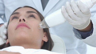 Potenza RF Microneedling Pack of 3 Treatments Potenza RF Microneedling Pack of 3 Treatments