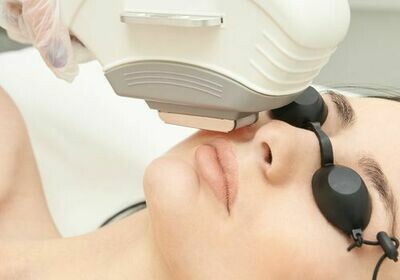 Full Face Laser Skin Resurfacing Full Face Laser Skin Resurfacing