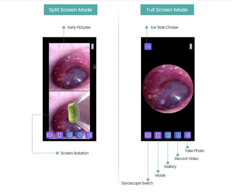 Wireless Otoscope Ear Camera with Dual View 720PHD WiFi Ear Scope Compatible with Android and iPhone