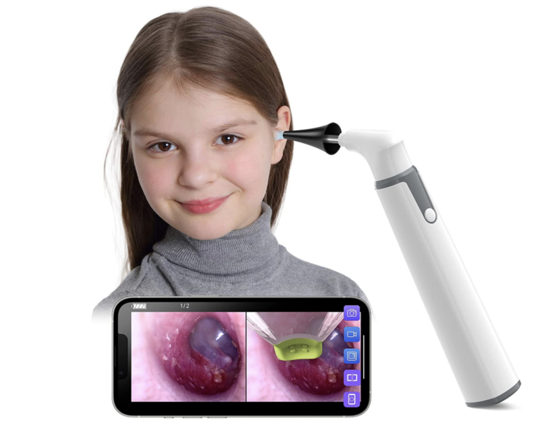 Wireless Otoscope Ear Camera with Dual View 720PHD WiFi Ear Scope Compatible with Android and iPhone