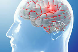 Crónicos y  mucho *DOLOR* trigemino, migraña articular
