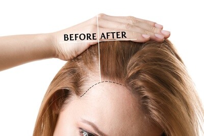 Hair Growth Treatment