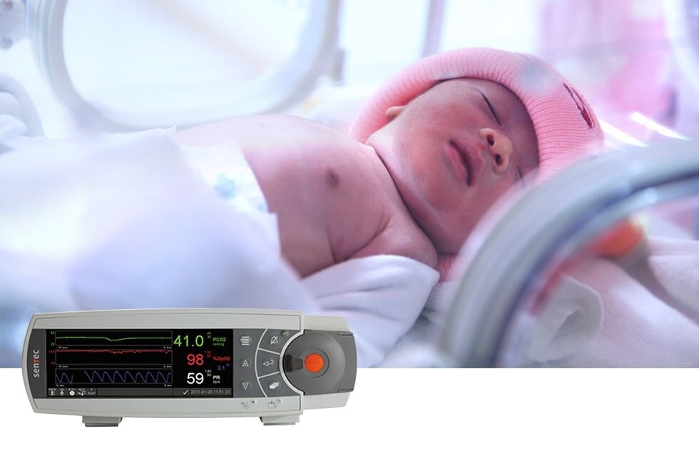 מוניטור דגם SDMS מערכת ניטור דיגיטלית דגם SDMS של חברת SENTEC מאפשרת ניטור רציף, לא פולשני של רמת  פחמן דו חמצני (pCO2) , ריווי חמצן (SpO2) ודופק בזמן אמת.