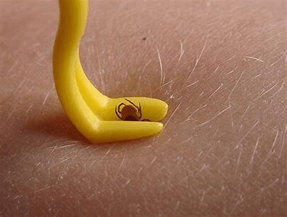 Tick Twister