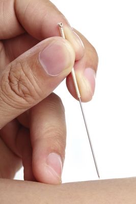 Koreanische Handakupunktur nach Tae-Woo Yoo