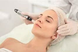 Advanced Skin Needling