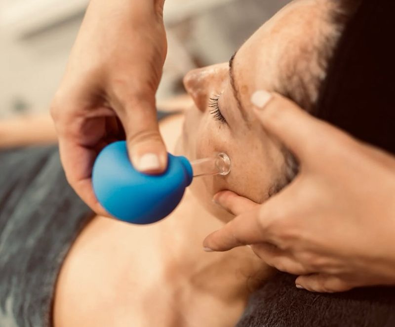 Massage éveil holistique aux ventouses (cupping facial)