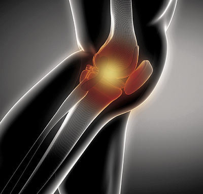 Artikel osteo-artritis