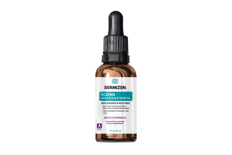 Dermizen Gentle Formula Eczema Body & Scalp Rash Oil (1 oz)