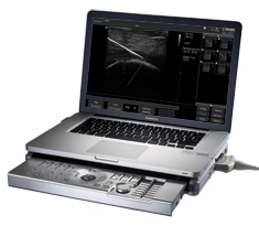 2 Year Rental - Terason t3200 w/1 Transducer