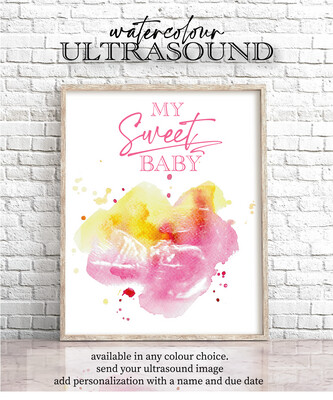 Watercolour Ultrasound Print