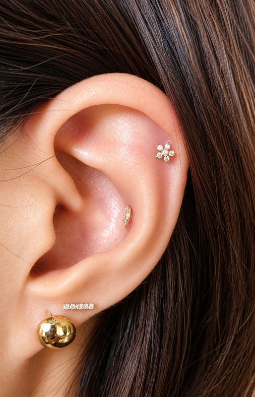 Flora Diamond Flatback