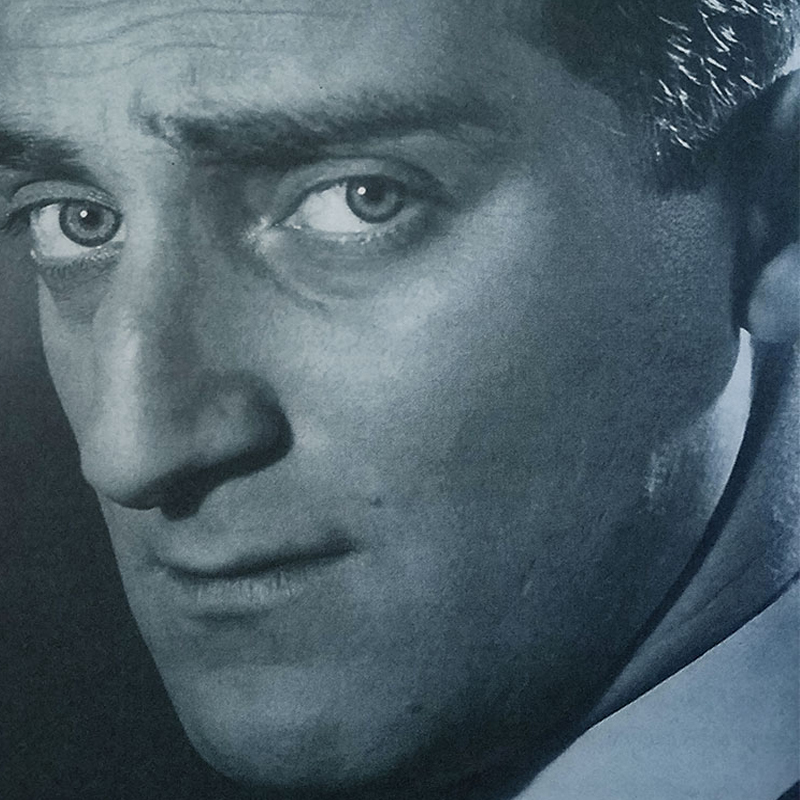 Marty Feldman, vita di una leggenda