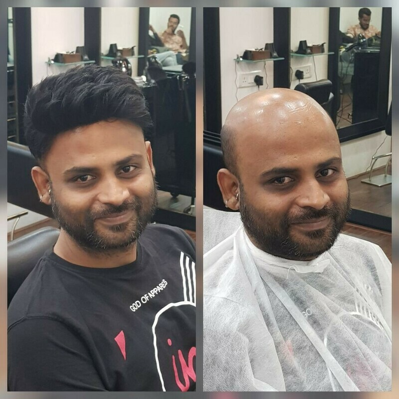 Non-Surgical Hair Replacement Services