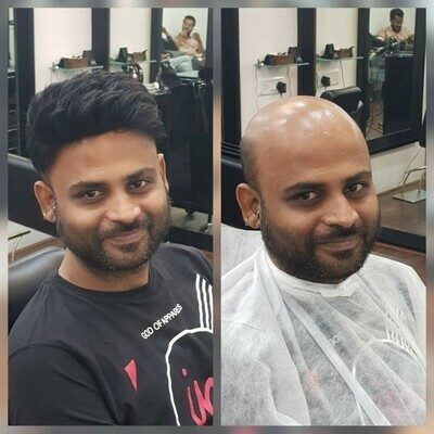 Non-Surgical Hair Replacement Services