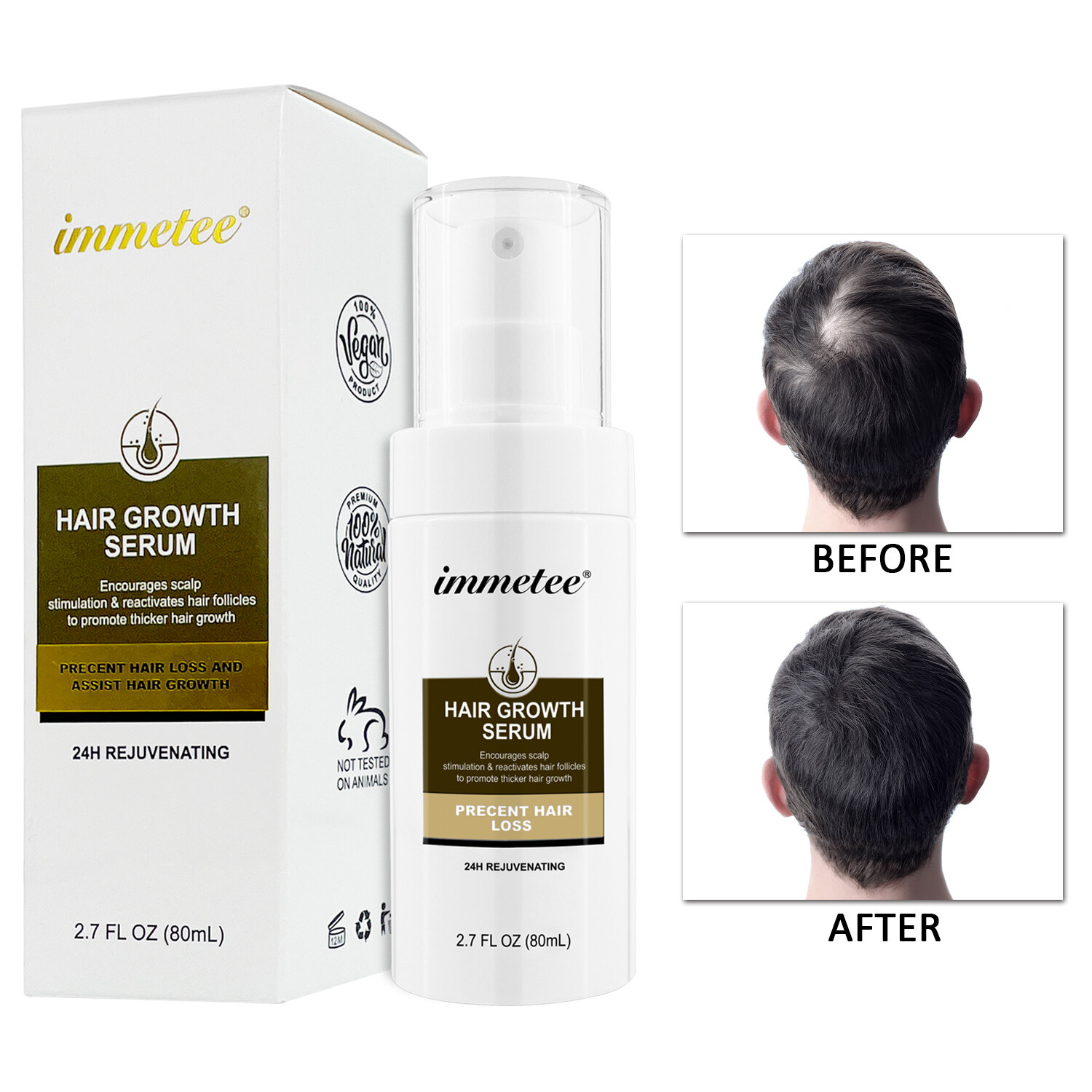 Immetee Hair Growth Serum - 80ml