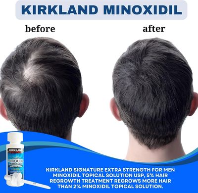 Kirkland Minoxidil 5% - MEN Hair Regrowth Solution 6 Month (1 Box)