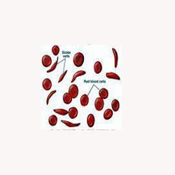 Sickle Cell Support