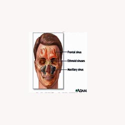 Sinus Support