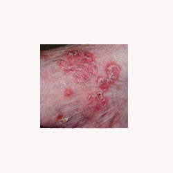 Skin Mix