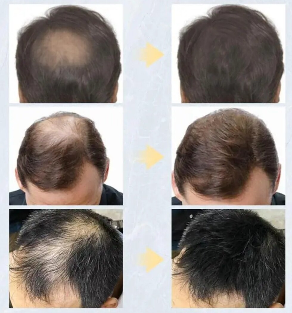 Toppik Keratin Hair Building Fibres 