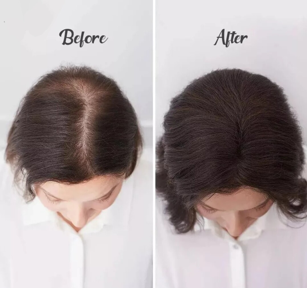 HUMAN HAIR TOPPER Mono Base 13x13cm