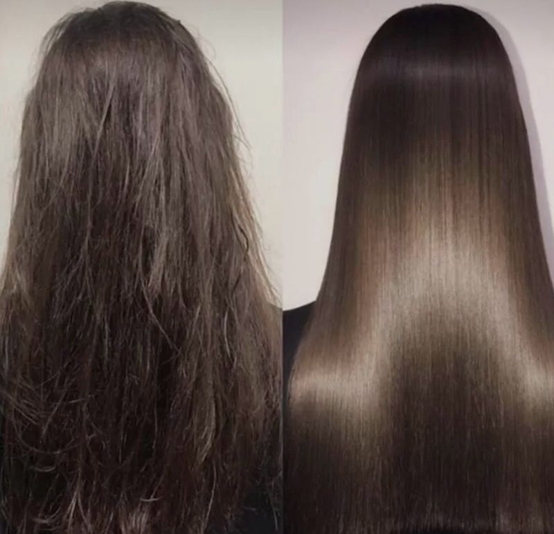 NANOPLASTY TREATMENT