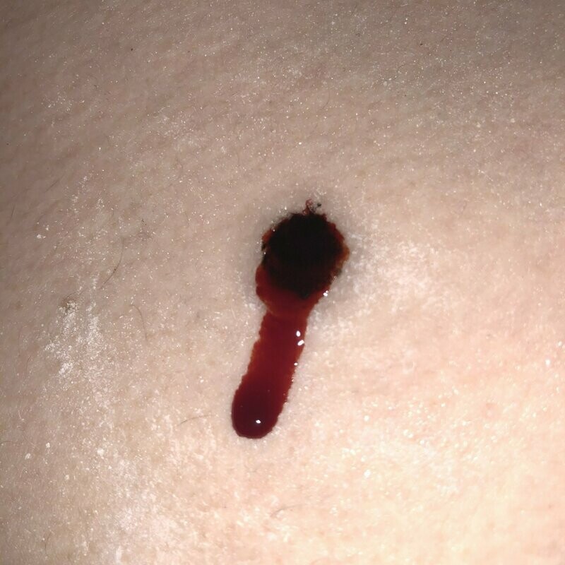 SkinArt Light (2x 70gram)