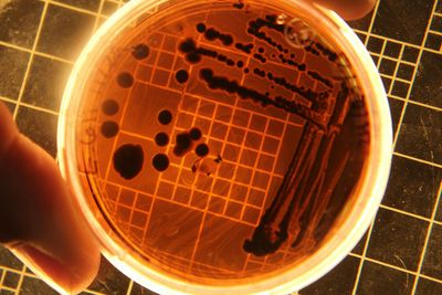 Salmonella Test for Compost