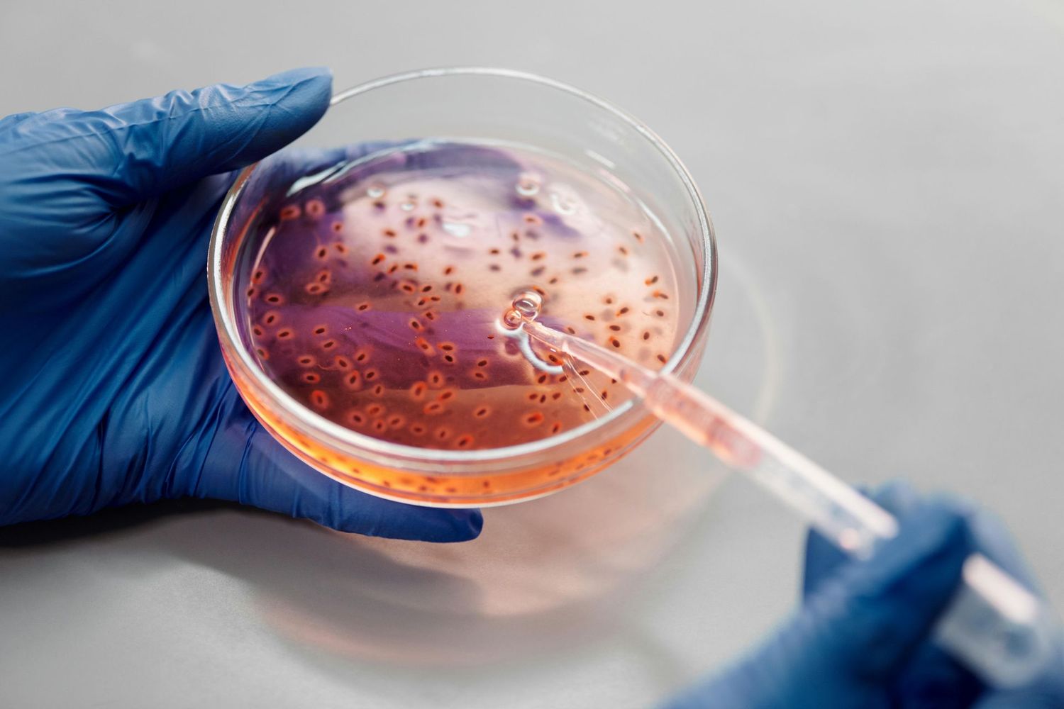 Fecal and Total Coliform Test