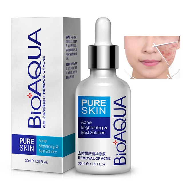 Bioaqua Acne Removal Essence Liquid