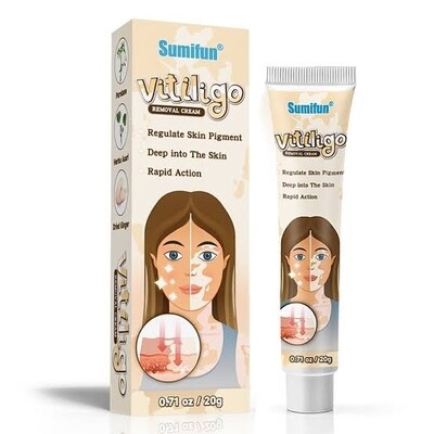 Vitiligo Removal Cream Vitiligo Cleansing Cream Facial Care Ointment