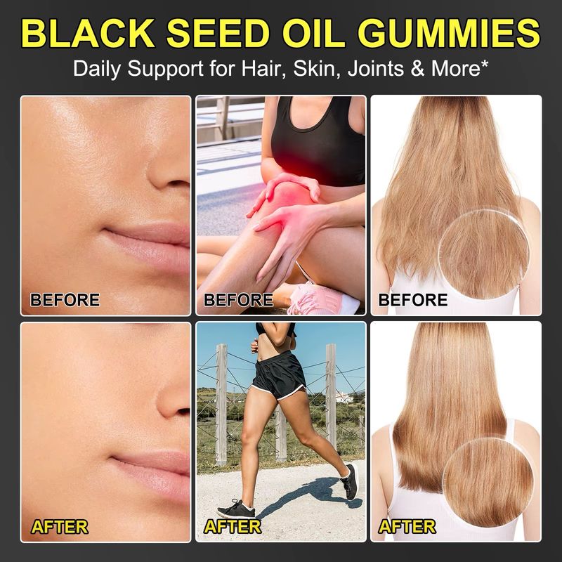 OneBtanicl Black Seed Oil Gummies