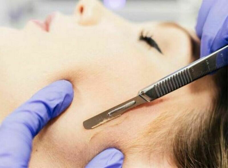 DERMAPLANNING &amp; BRIGHTENING TREATMENTS - 4 TREATMENTS PACKAGE