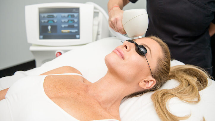 PHOTOFACIAL - 4 TREATMENTS PACKAGE