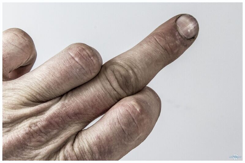 Stinkefinger