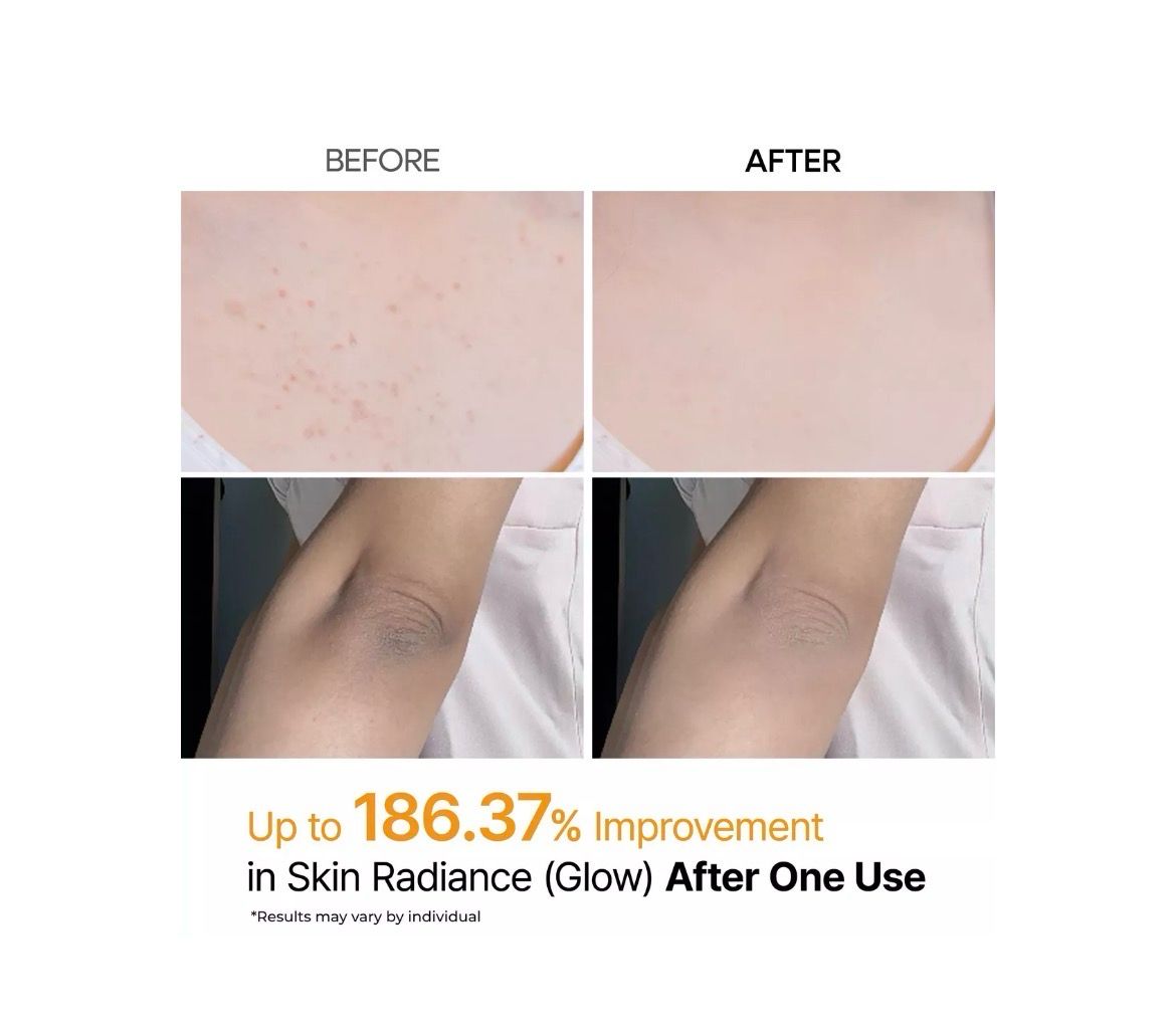 Dr.Melaxin Peel Shot Kojic Acid Tumeric Spray .🧡