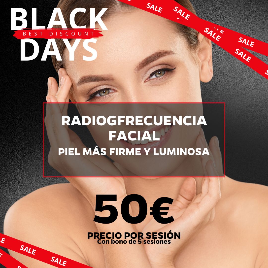 5 SESIONES RADIOFRECUENCIA FACIAL