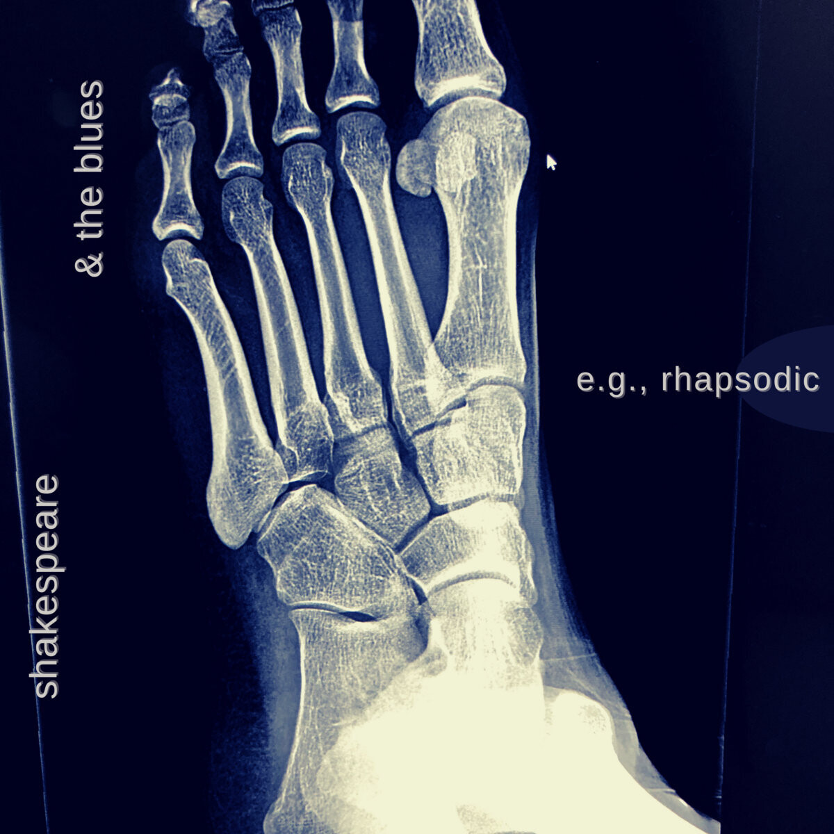 Shakespeare &amp; The Blues &quot;e.g., rhapsodic&quot; 