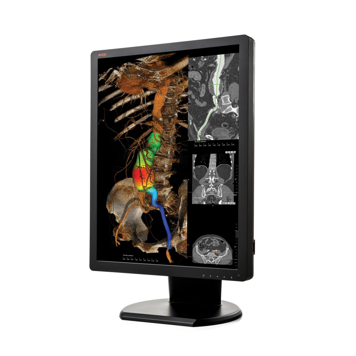Wide Co.  Diagnostic Radiology Display Monitor Screen - מסך פיענוח רפואי
