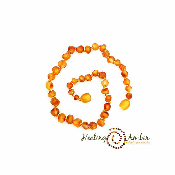 Healing Amber 11" Raw Caramel Amber necklace