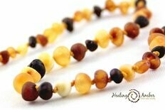 Healing Amber 11" Raw Multi Amber Necklace