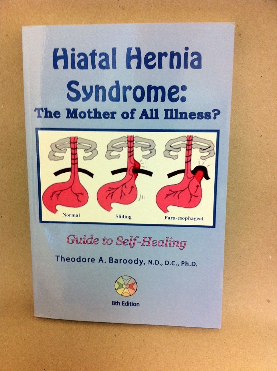 Hiatal Hernia Syndrome Hiatal Hernia Syndrome