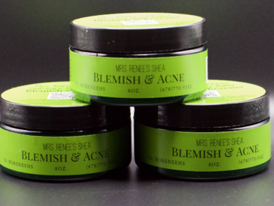 Blemish & Eczema Body Butter(plus 1 free bar Of Soap) Blemish & Eczema Body Butter(plus 1 free bar Of Soap)