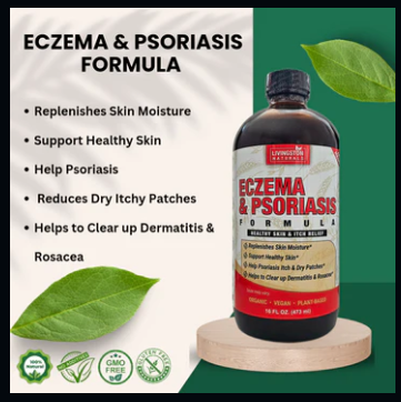 Eczema and Psoriasis