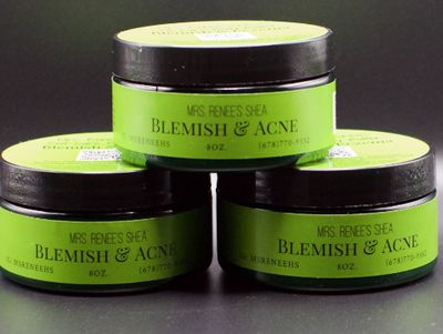 Blemish &amp; Eczema Body Butter(plus 1 free bar Of Soap)