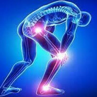 中度骨關節炎 | Moderate Osteoarthritis