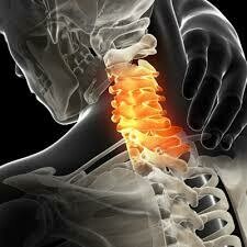 頸椎退化 (富貴包) | Cervical Degeneration