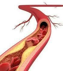 血壓及膽固醇 | Blood Pressure & Cholesterol